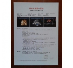医用B超/放射胶片—医用激光胶片