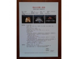 医用B超/放射胶片—医用激光胶片
